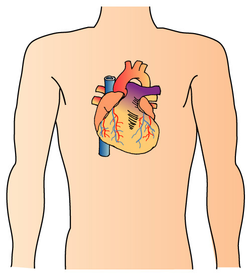 心臓もサルコイドーシスの影響を受けることがあり注意が必要です。不整脈も心不全もかなり治せます。