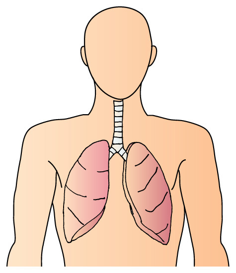 肺はサルコイドーシスにもっともやられやすい臓器のひとつです