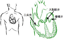 心臓の弁のうち３つを示します