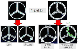 大動脈弁形成術の基本コンセプトを示します