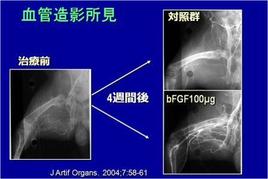 動物実験のデータ。ｂFGF徐放は多数の血管を作ることで血のめぐりを改善します。写真で一目でわかるほどの効果があります。