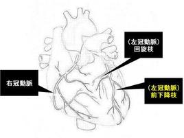 冠動脈の3つの系統を示します。3系統とも病気でやられている場合や左冠動脈の2系統の根本が狭くなっている場合は要注意です。