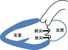 僧帽弁の逸脱（いつだつ）の様子を矢印でしめします