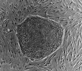 ＥＳ細胞。延々と増え続け、さまざまな細胞になれる特徴を将来治療に活かすべく研究が進んでいます