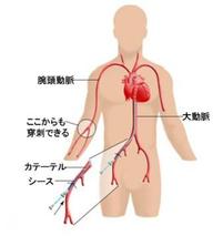 心カテーテル検査は有用ですが、心臓手術の前後には不要なことも多くなりました