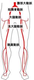 下半身を支える動脈です。これらが詰まったり狭くなったりすると治療が必要になります