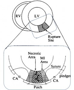 EpiEnd