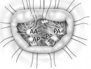 PHOLA1