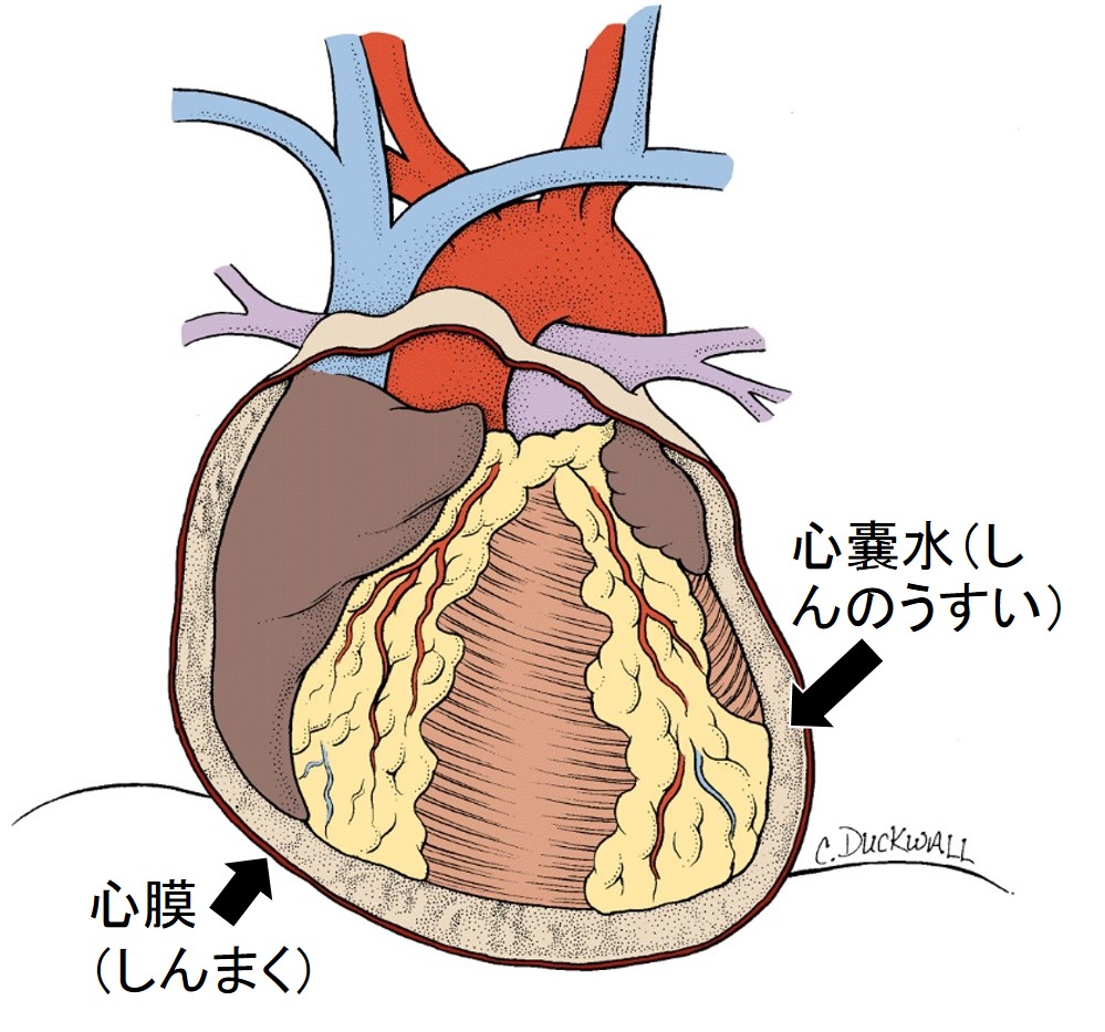 心臓 に 水